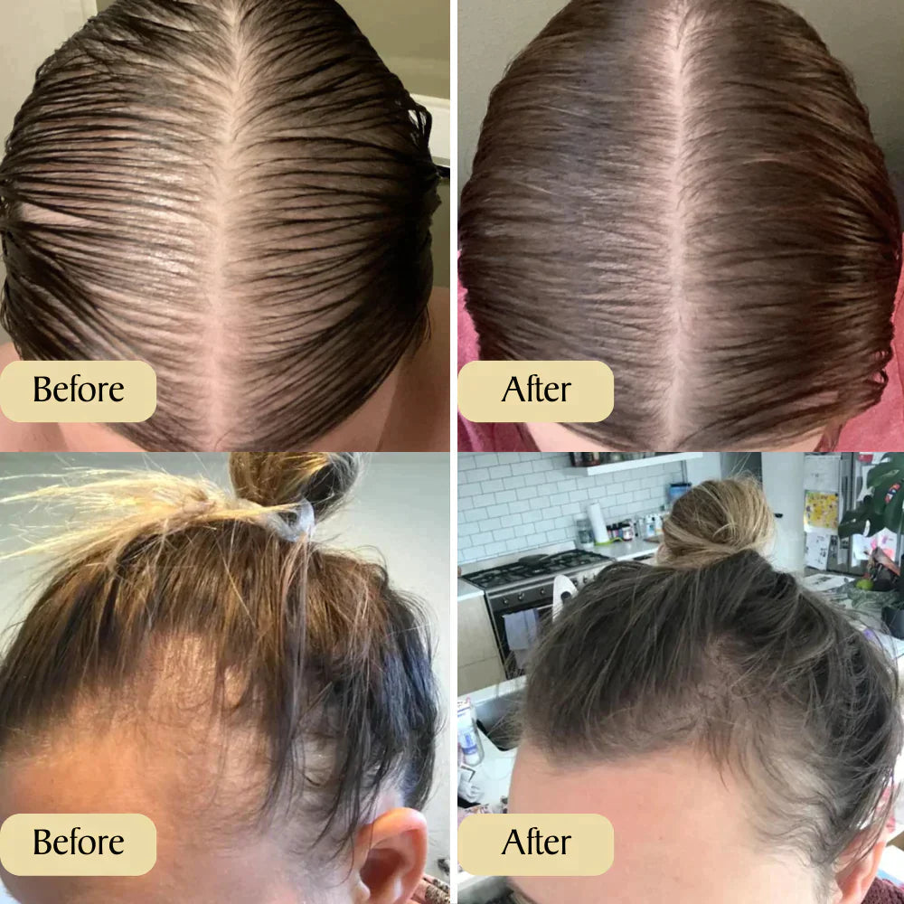 Dichteres, volleres Haar mit Carvenchy Haaröl. Naturpflege für verbessertes Haarwachstum.