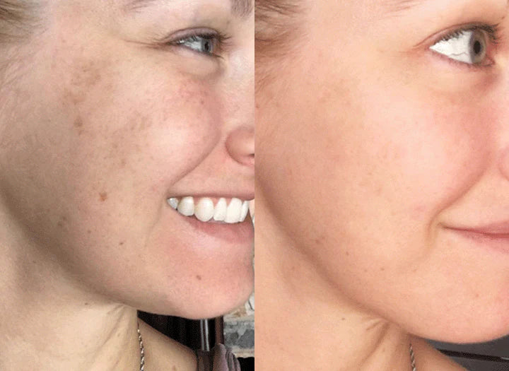 Hautpflege Kurkuma-Serum korrigiert Pigmentflecken & dunkle Flecken für einen ebenmäßigen, strahlenden Teint.