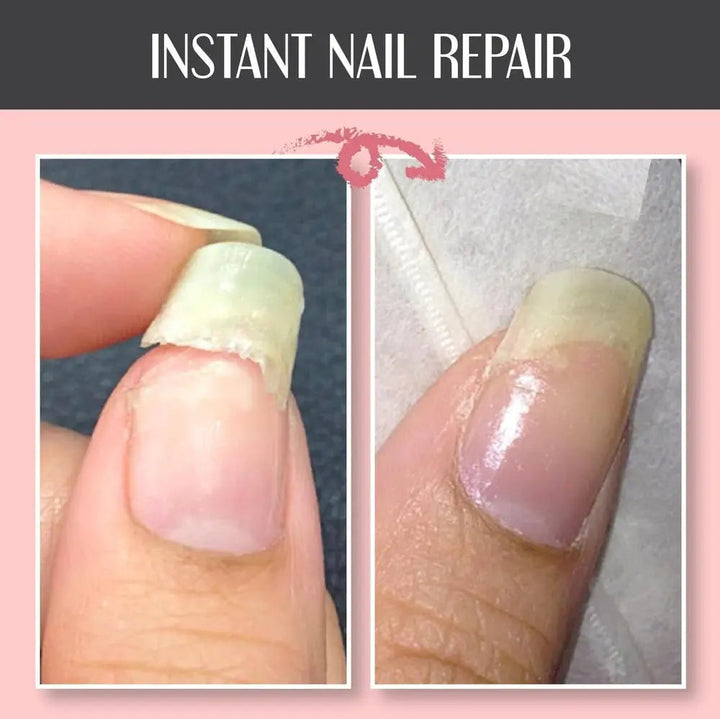 Nahaufnahme: Nagelreparatur Schutzgel, UV-lichtfrei. Effektive Sofort-Hilfe gegen brüchige Nägel & für Nagelpflege.