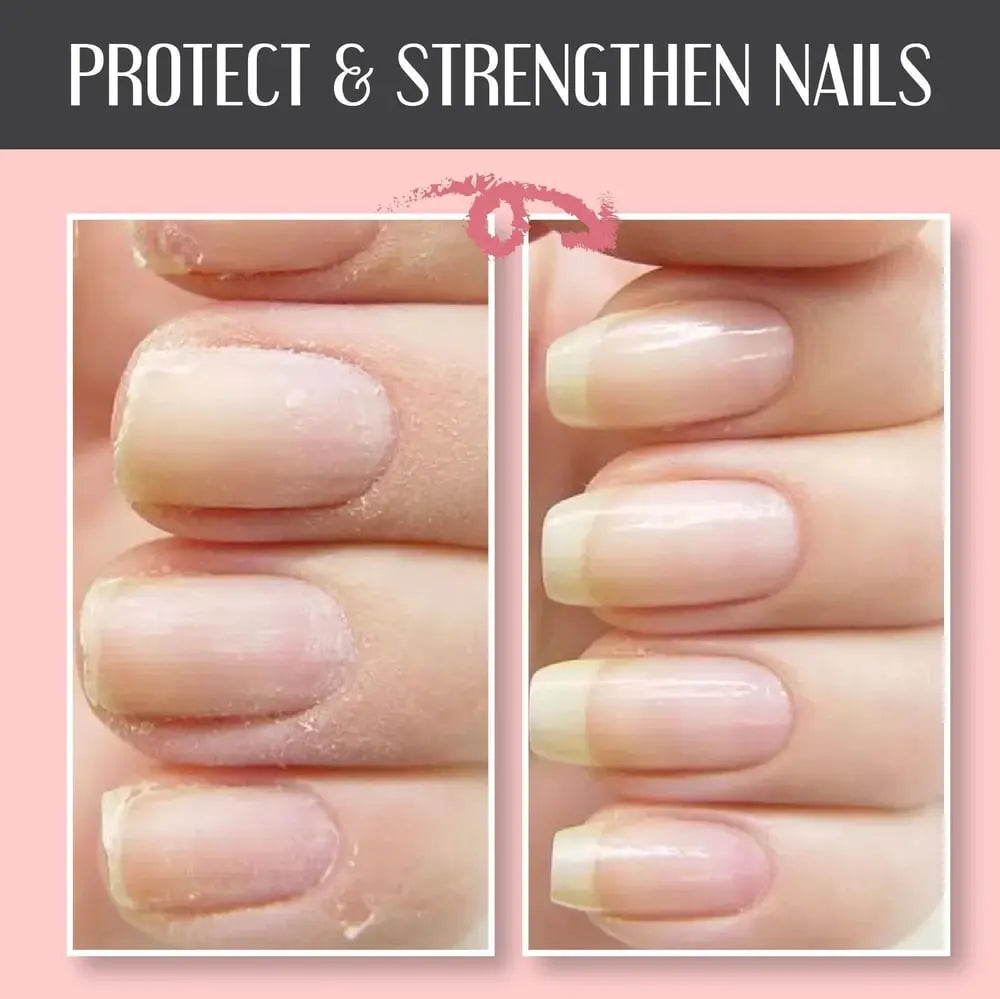 Anwendung des Nagelreparatur Gels, UV-lichtfrei. Repariert & schützt brüchige Nägel für eine perfekte Maniküre.