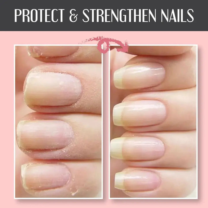 Anwendung des Nagelreparatur Gels, UV-lichtfrei. Repariert & schützt brüchige Nägel für eine perfekte Maniküre.