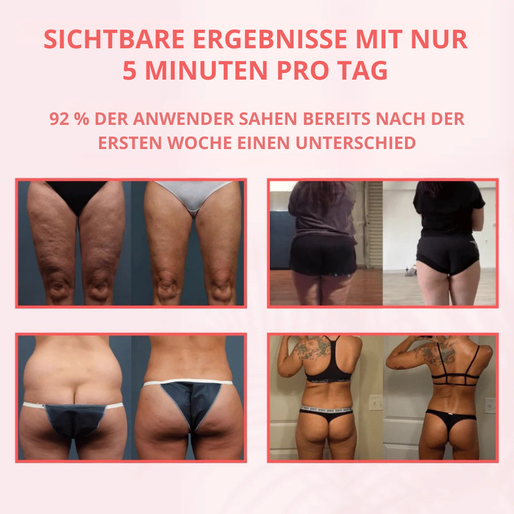 Massagegerät für Damen mit Wärme, Vibration und Schröpfen zur Reduzierung von Cellulite und Dehnungsstreifen.
