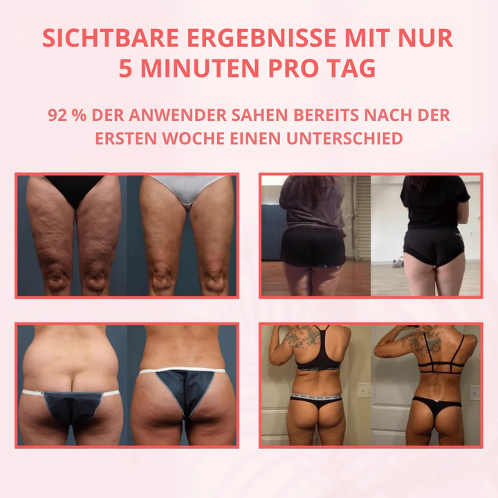 Massagegerät für Damen mit Wärme, Vibration und Schröpfen zur Reduzierung von Cellulite und Dehnungsstreifen.