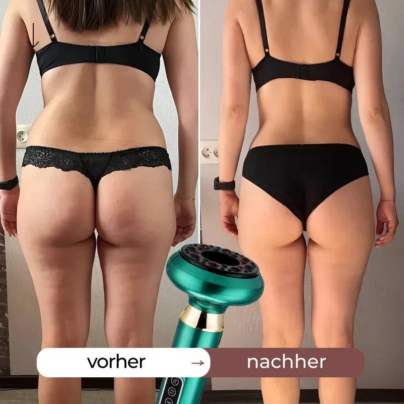 Leistungsstarkes 4-in-1 Cellulite-Massagegerät: Infrarot, Schröpfen, Wärme & Vibration für Frauen.