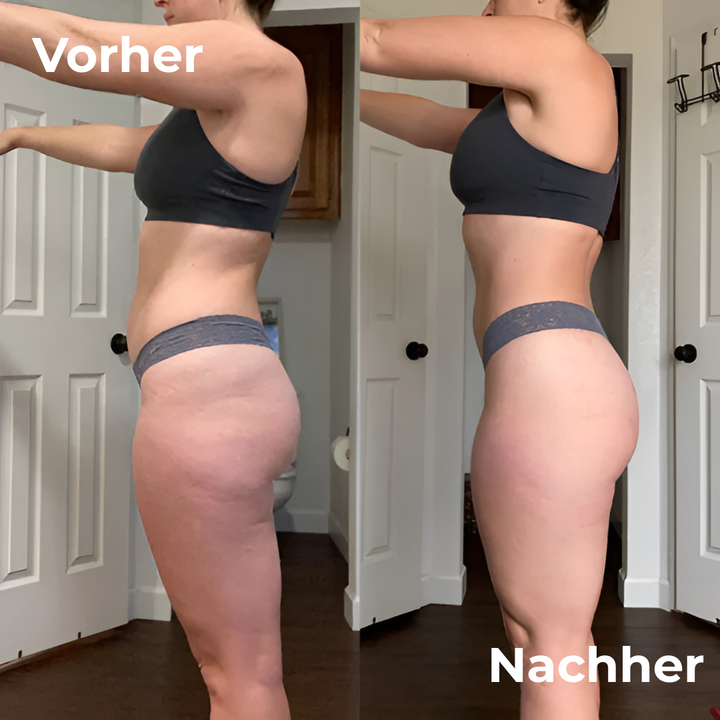 Manueller Cellulite-Roller für Damen zur Reduzierung von Cellulite & Steigerung des Wohlbefindens.