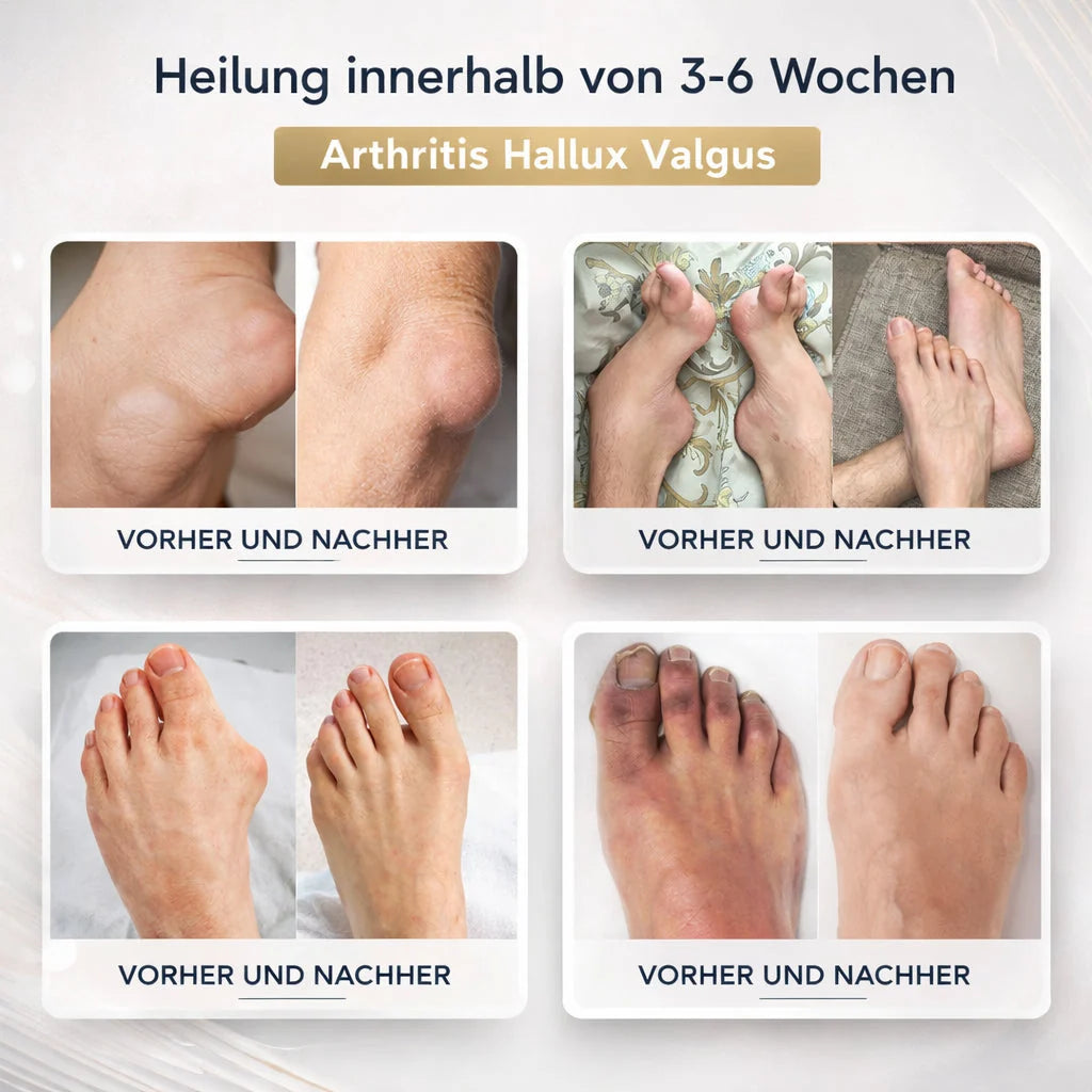 Elegante Verpackung der Nährenden Gesichtscreme, Anti-Aging Pflege für strahlende Haut. Mit Hyaluron.